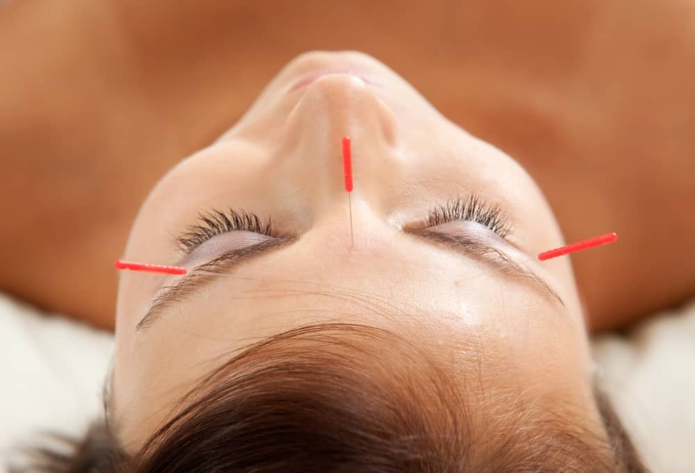 Can Acupuncture Help an Alzheimer's Patient? about false
