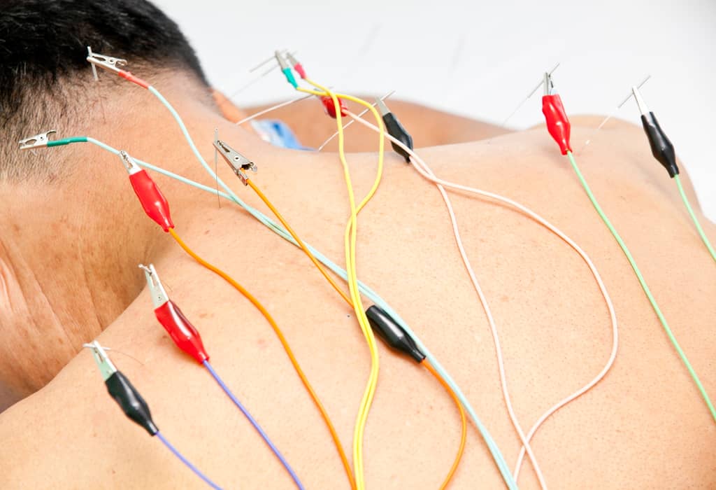 Can Acupuncture Help an Alzheimer’s Patient? about false