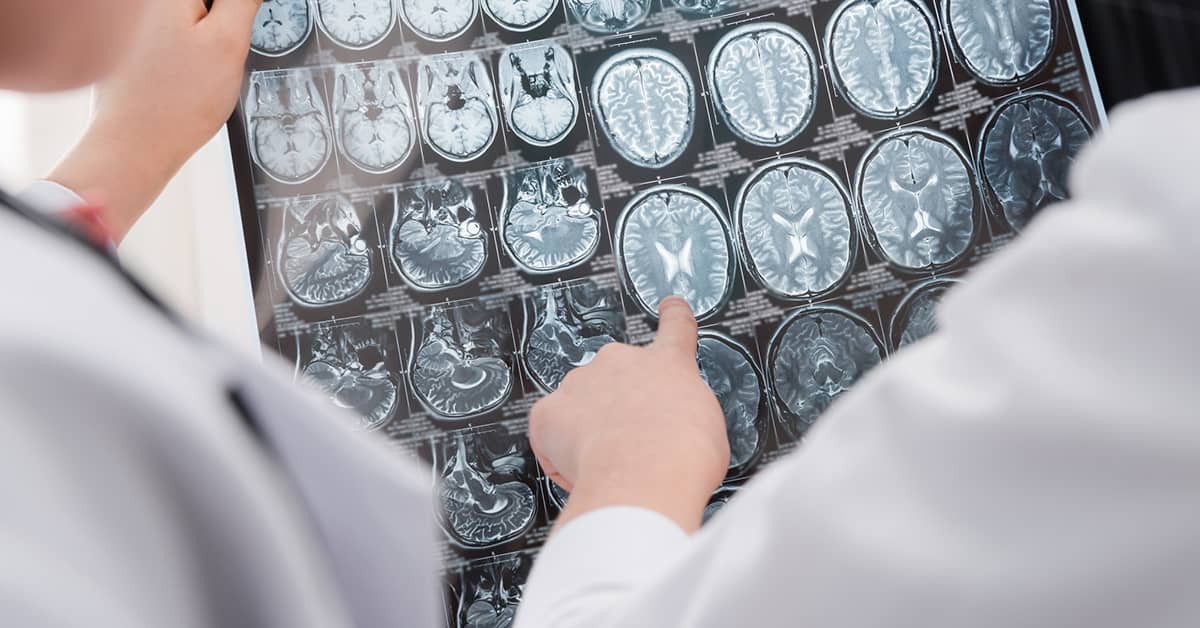 This Simple Device Could Soon Be Used to Treat Alzheimer's about undefined