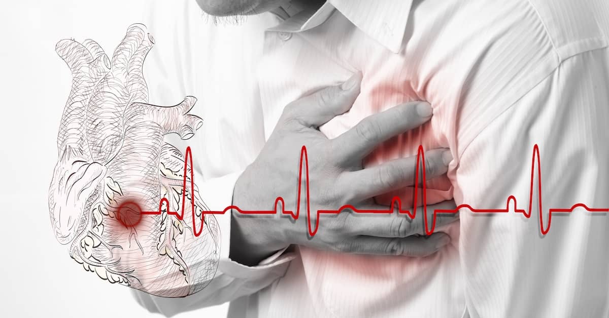 Unhealthy Heart and Circulation Equals Huge Increase in Dementia Risk about undefined