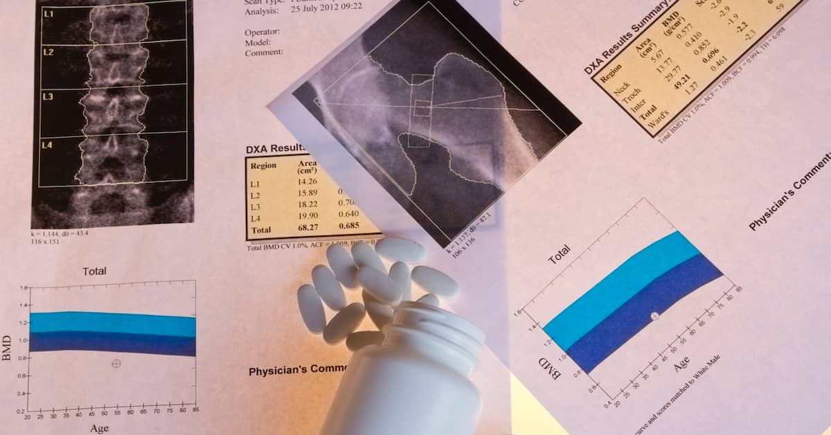 Connection Found Between Dementia and Common Health Problem about undefined