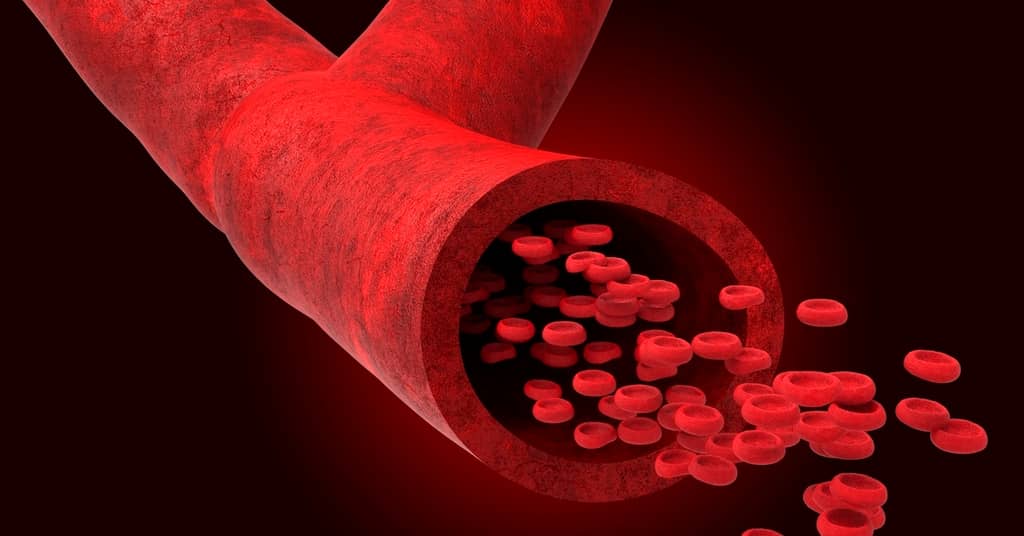 A Leaky Brain Could be The Chief Culprit in Alzheimer's about false