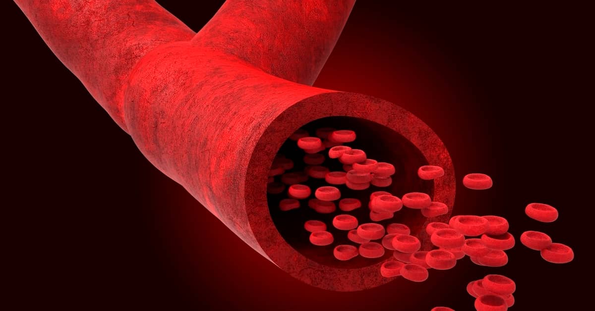 A Leaky Brain Could be The Chief Culprit in Alzheimer's about undefined