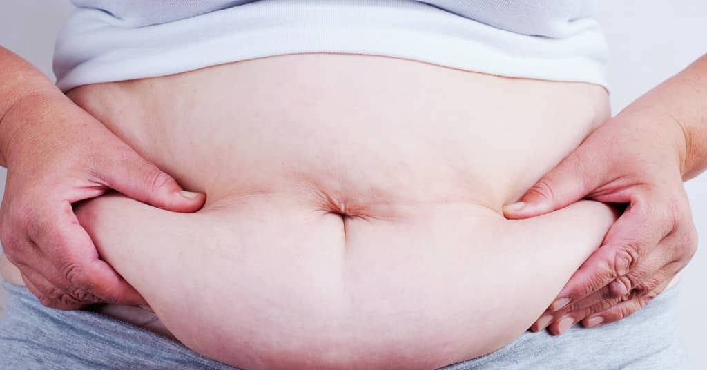 Excessive Belly Fat Linked to Smaller Brain about false
