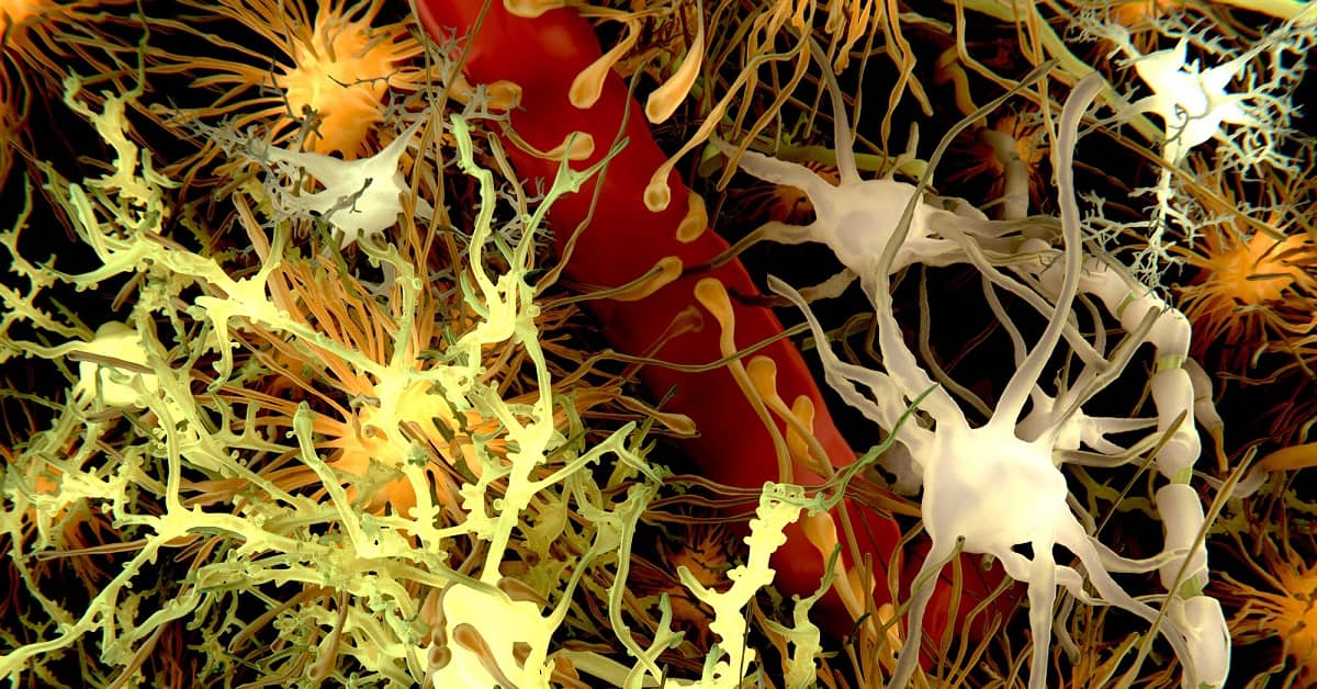 Clearing Away Toxic Alzheimer's Proteins in the Brain Using Genes about undefined
