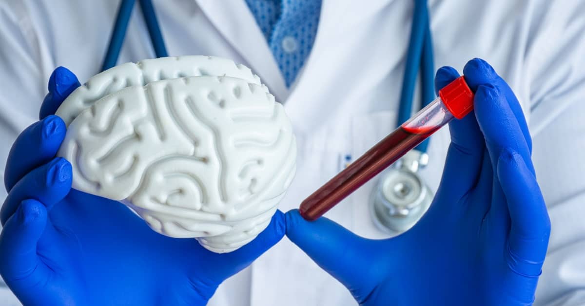 How Close are We to a Blood Test for Alzheimer’s? about undefined