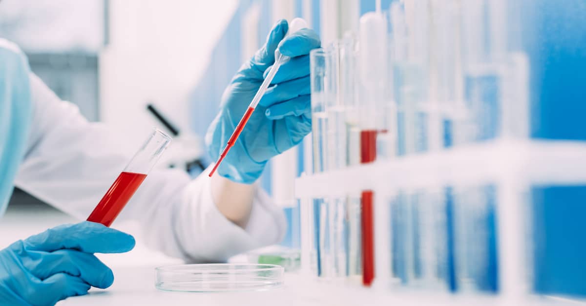 Highly Accurate Blood Test Predicts Alzheimer's Four Years in Advance about undefined