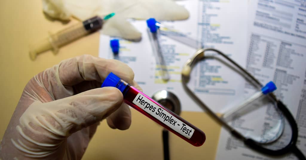 Solving This Viral Puzzle Unlocks Cause (And Maybe Treatment For) Alzheimer’s Disease about false