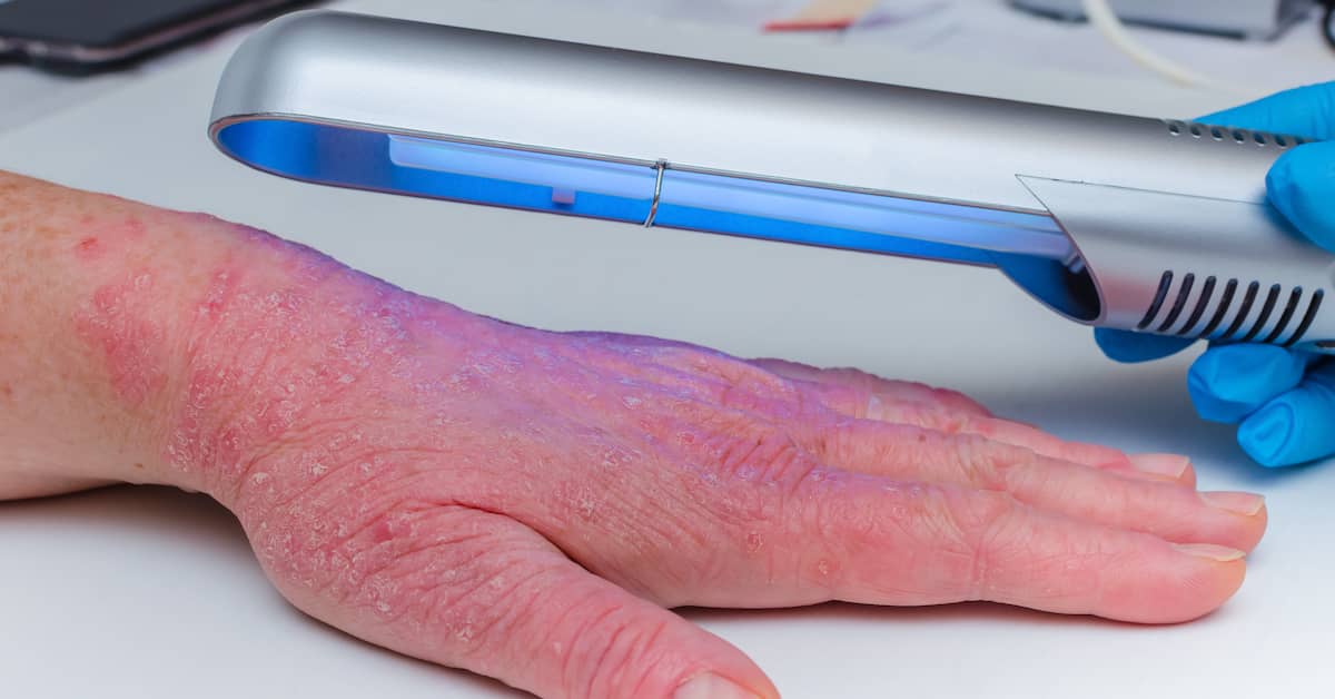 New “Smart Patch” Offers Fast Way To Detect Alzheimer’s Disease about undefined